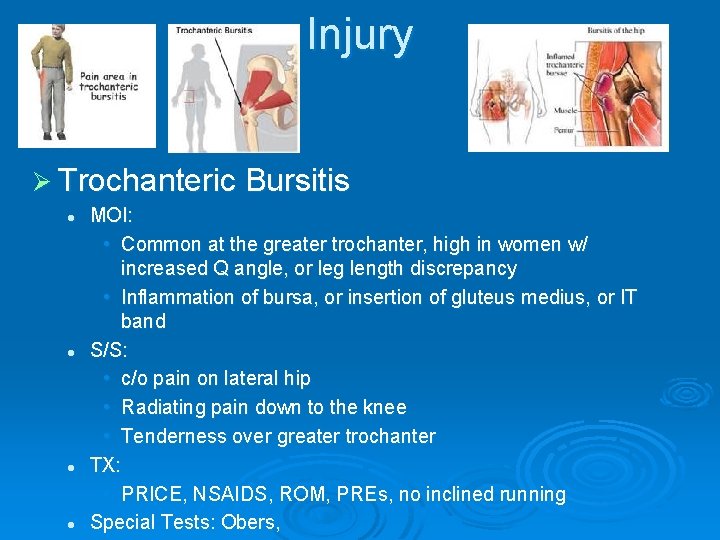Injury Ø Trochanteric Bursitis l l MOI: • Common at the greater trochanter, high