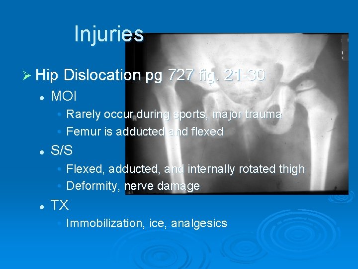 Injuries Ø Hip Dislocation pg 727 fig. 21 -30 l MOI • Rarely occur