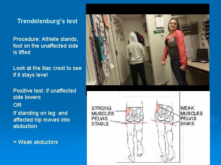 Trendelenburg’s test Procedure: Athlete stands, foot on the unaffected side is lifted Look at