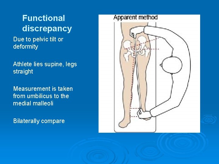 Functional discrepancy Due to pelvic tilt or deformity Athlete lies supine, legs straight Measurement