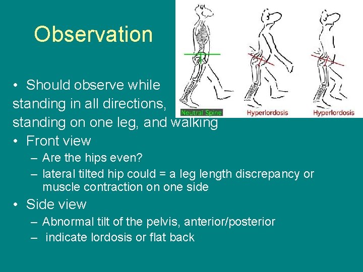 Observation • Should observe while standing in all directions, standing on one leg, and