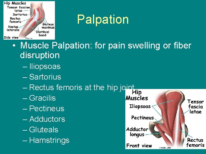 Palpation • Muscle Palpation: for pain swelling or fiber disruption – Iliopsoas – Sartorius