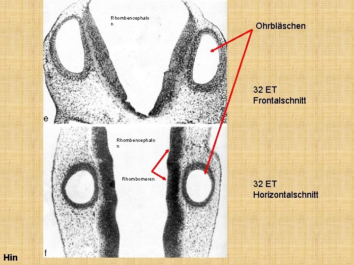 Rhombencephalo n Ohrbläschen 32 ET Frontalschnitt Rhombencephalo n Rhombomeren Hin 32 ET Horizontalschnitt 