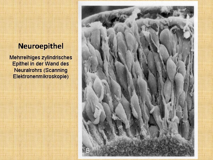 Neuroepithel Mehrreihiges zylindrisches Epithel in der Wand des Neuralrohrs (Scanning Elektronenmikroskopie) 