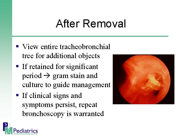 After Removal § View entire tracheobronchial tree for additional objects § If retained for