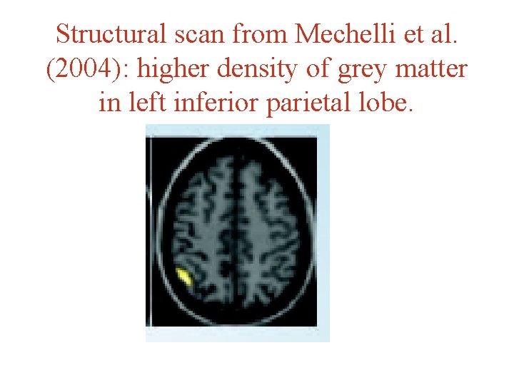 Structural scan from Mechelli et al. (2004): higher density of grey matter in left