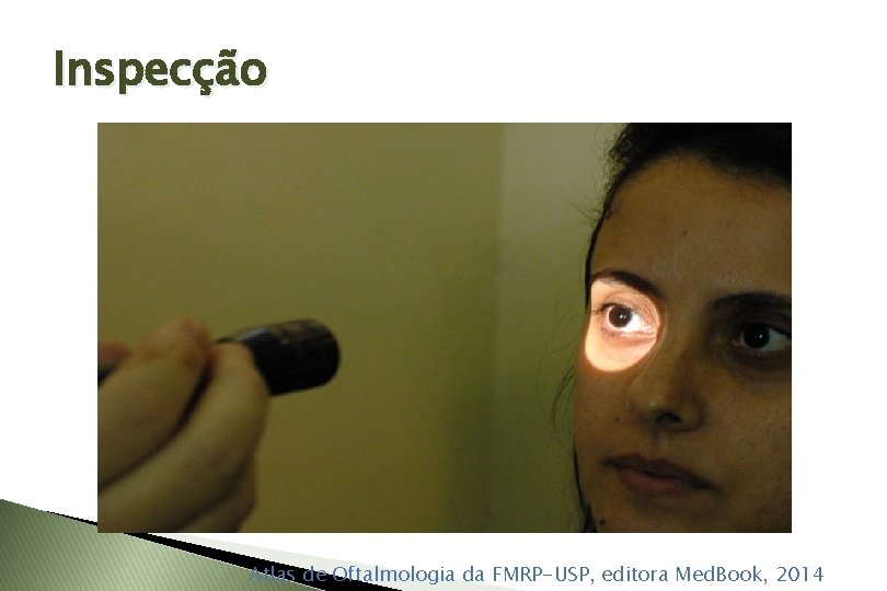 Inspecção Atlas de Oftalmologia da FMRP-USP, editora Med. Book, 2014 