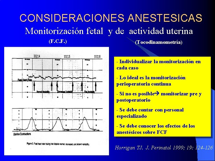 CONSIDERACIONES ANESTESICAS Monitorización fetal y de actividad uterina (F. C. F. ) (Tocodinamometría) -