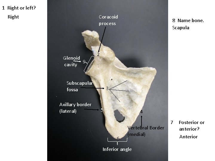 1 Right or left? Right Coracoid process Glenoid 9 cavity 2 Subscapular fossa Axillary