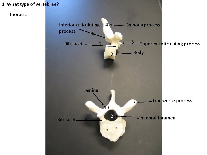 1 What type of vertebrae? Thoracic Inferior articulating process 6 Rib facet 4 Spinous