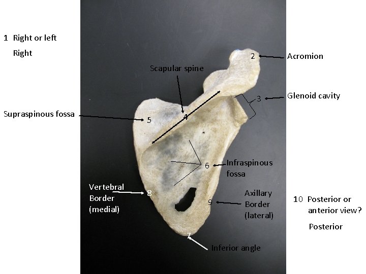 1 Right or left Right 2 Acromion Scapular spine 3 Supraspinous fossa 5 4