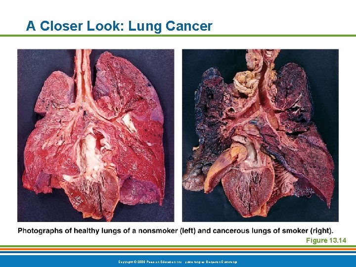 A Closer Look: Lung Cancer Figure 13. 14 Copyright © 2009 Pearson Education, Inc.