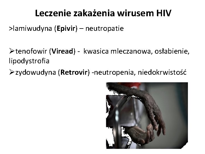 Leczenie zakażenia wirusem HIV >lamiwudyna (Epivir) – neutropatie Øtenofowir (Viread) - kwasica mleczanowa, osłabienie,