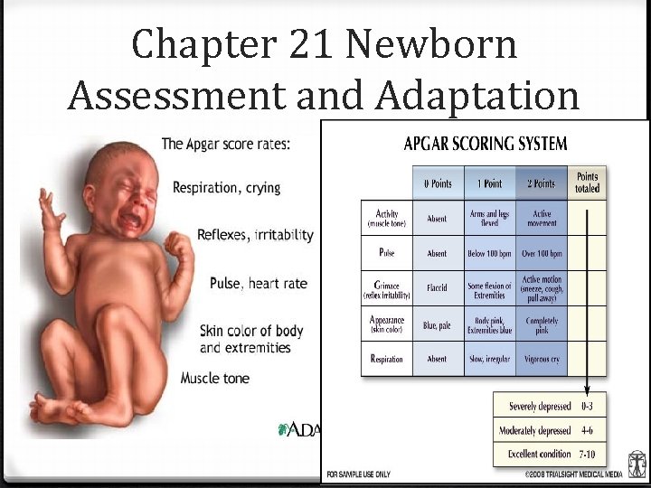 Chapter 21 Newborn Assessment and Adaptation 
