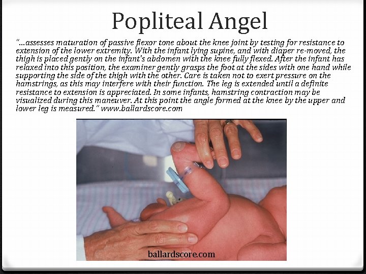 Popliteal Angel “…assesses maturation of passive flexor tone about the knee joint by testing