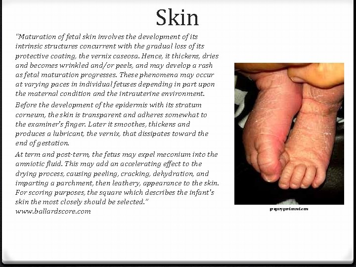 Skin “Maturation of fetal skin involves the development of its intrinsic structures concurrent with