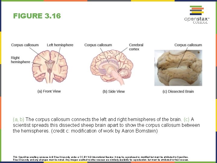 FIGURE 3. 16 (a, b) The corpus callosum connects the left and right hemispheres