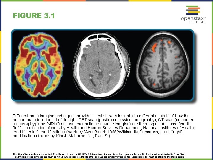 FIGURE 3. 1 Different brain imaging techniques provide scientists with insight into different aspects