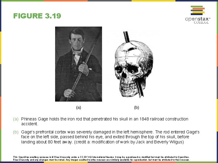 FIGURE 3. 19 (a) Phineas Gage holds the iron rod that penetrated his skull