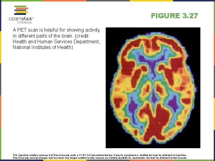 FIGURE 3. 27 A PET scan is helpful for showing activity in different parts