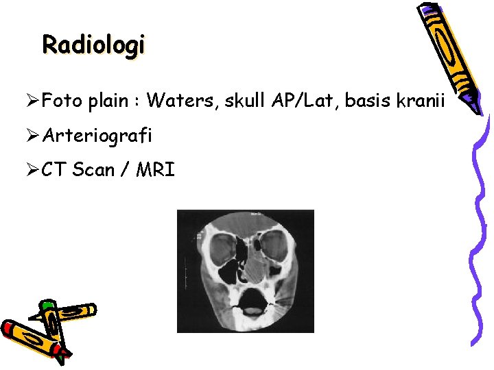 Radiologi ØFoto plain : Waters, skull AP/Lat, basis kranii ØArteriografi ØCT Scan / MRI