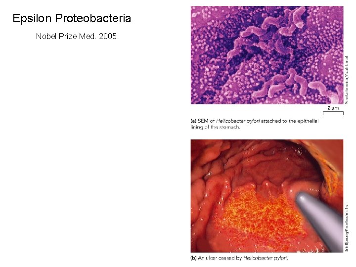 Epsilon Proteobacteria Nobel Prize Med. 2005 