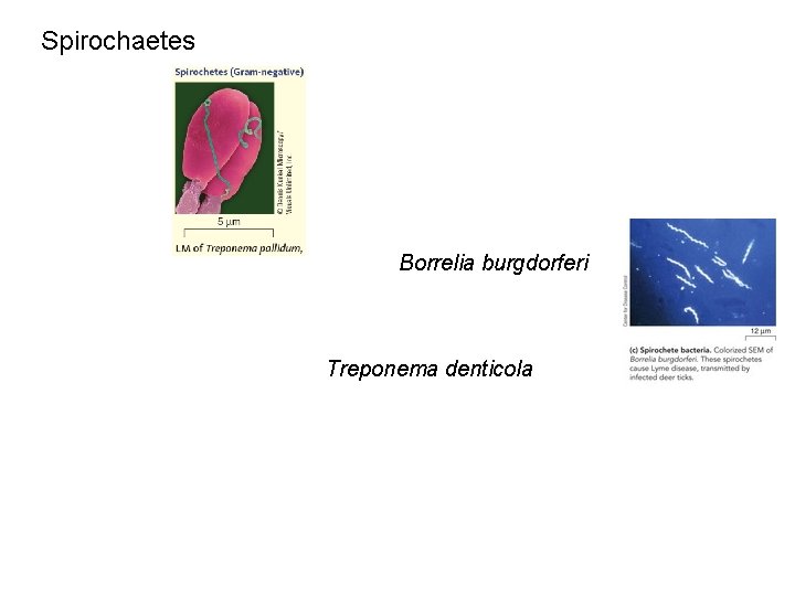 Spirochaetes Borrelia burgdorferi Treponema denticola 