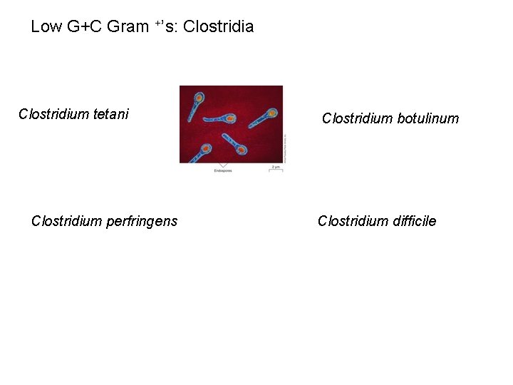 Low G+C Gram +’s: Clostridia Clostridium tetani Clostridium perfringens Clostridium botulinum Clostridium difficile 