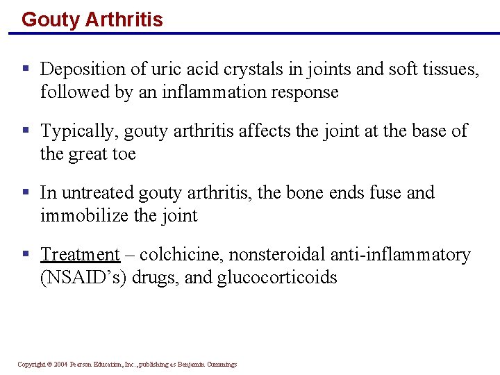 Gouty Arthritis § Deposition of uric acid crystals in joints and soft tissues, followed