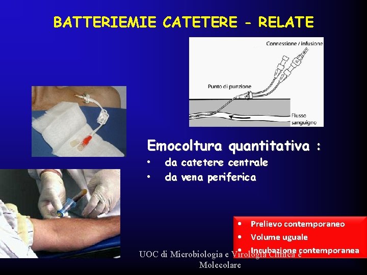 BATTERIEMIE CATETERE - RELATE Emocoltura quantitativa : • • da catetere centrale da vena