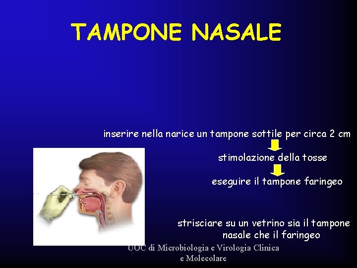TAMPONE NASALE inserire nella narice un tampone sottile per circa 2 cm stimolazione della