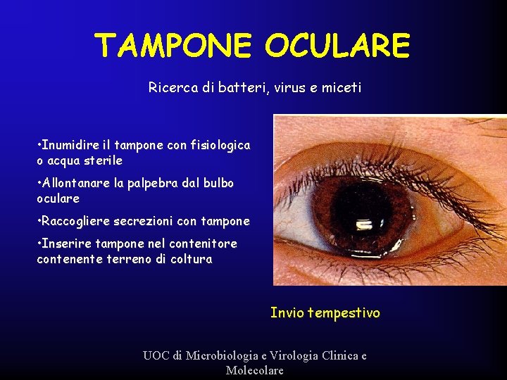 TAMPONE OCULARE Ricerca di batteri, virus e miceti • Inumidire il tampone con fisiologica