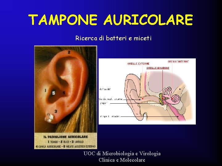 TAMPONE AURICOLARE Ricerca di batteri e miceti UOC di Microbiologia e Virologia Clinica e