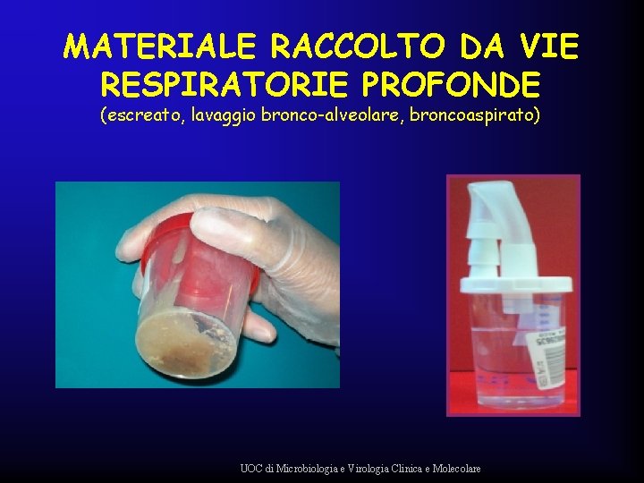 MATERIALE RACCOLTO DA VIE RESPIRATORIE PROFONDE (escreato, lavaggio bronco-alveolare, broncoaspirato) UOC di Microbiologia e