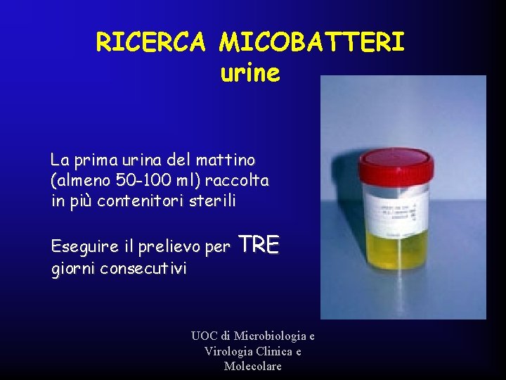 RICERCA MICOBATTERI urine La prima urina del mattino (almeno 50 -100 ml) raccolta in