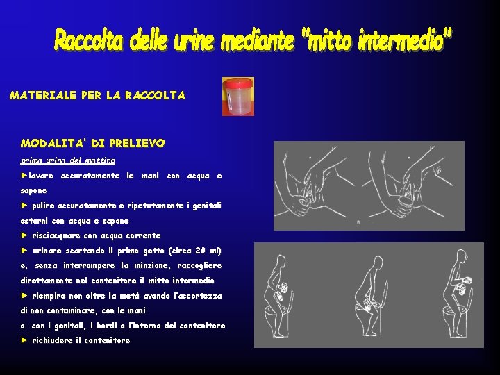 MATERIALE PER LA RACCOLTA MODALITA’ DI PRELIEVO prima urina del mattino ►lavare accuratamente le