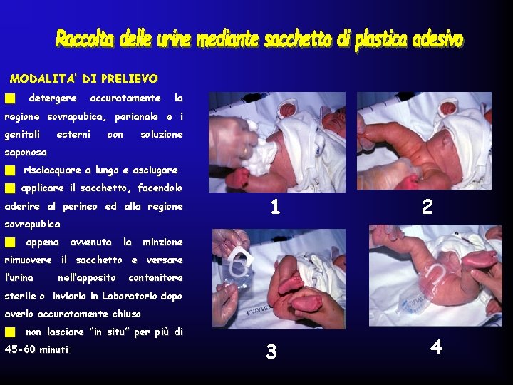 MODALITA’ DI PRELIEVO g detergere accuratamente la regione sovrapubica, perianale e i genitali esterni