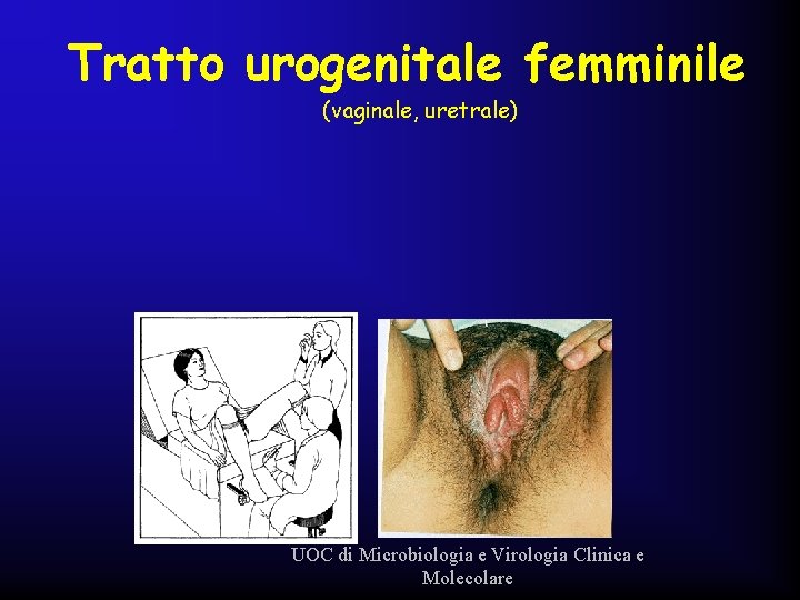 Tratto urogenitale femminile (vaginale, uretrale) UOC di Microbiologia e Virologia Clinica e Molecolare 