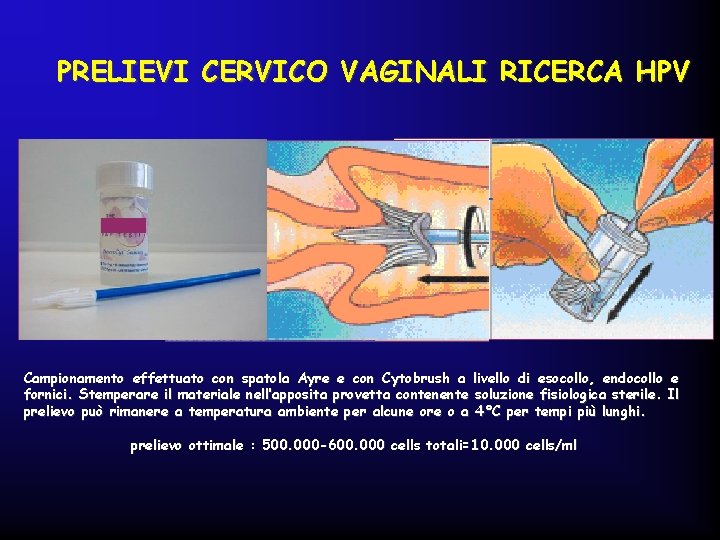 PRELIEVI CERVICO VAGINALI RICERCA HPV Campionamento effettuato con spatola Ayre e con Cytobrush a