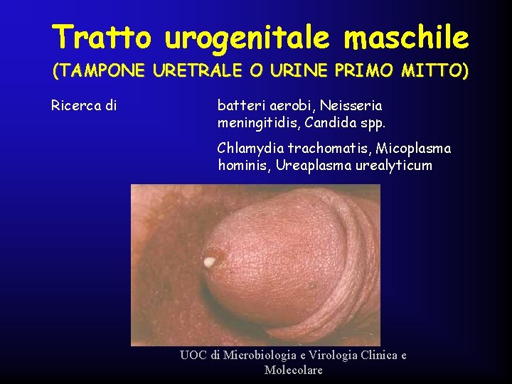 Tratto urogenitale maschile (TAMPONE URETRALE O URINE PRIMO MITTO) Ricerca di batteri aerobi, Neisseria