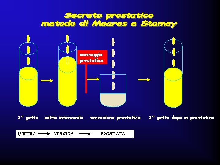 massaggio prostatico 1° getto mitto intermedio URETRA VESCICA secrezione prostatica PROSTATA 1° getto dopo