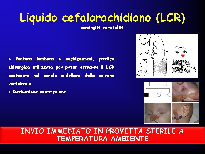 Liquido cefalorachidiano (LCR) meningiti-encefaliti Ø Puntura lombare o rachicentesi, rachicentesi pratica chirurgica utilizzata per