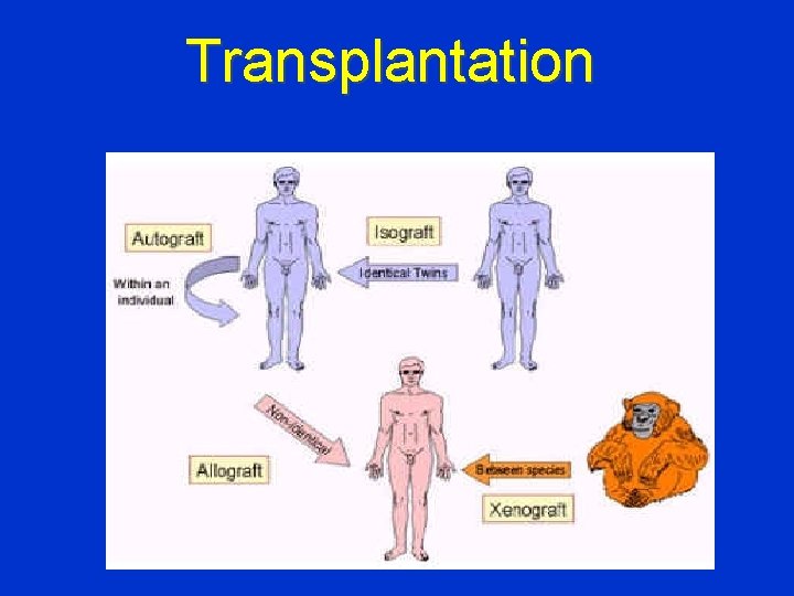 Transplantation 