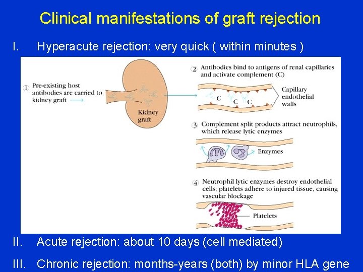Clinical manifestations of graft rejection I. Hyperacute rejection: very quick ( within minutes )