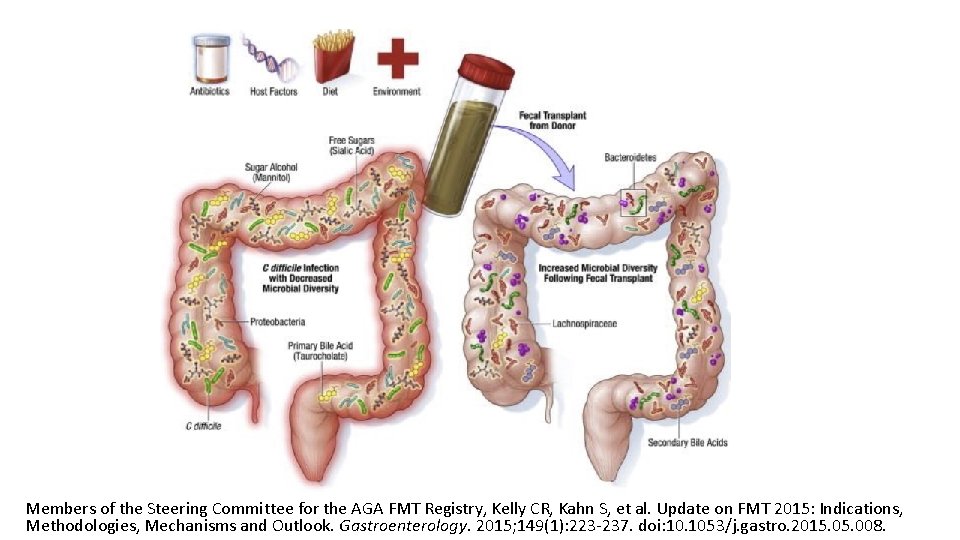 Members of the Steering Committee for the AGA FMT Registry, Kelly CR, Kahn S,