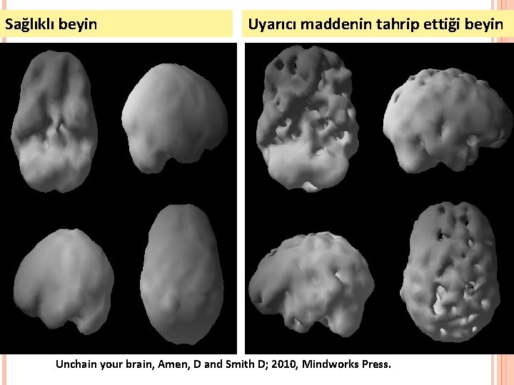 Sağlıklı beyin Uyarıcı maddenin tahrip ettiği beyin Unchain your brain, Amen, D and Smith