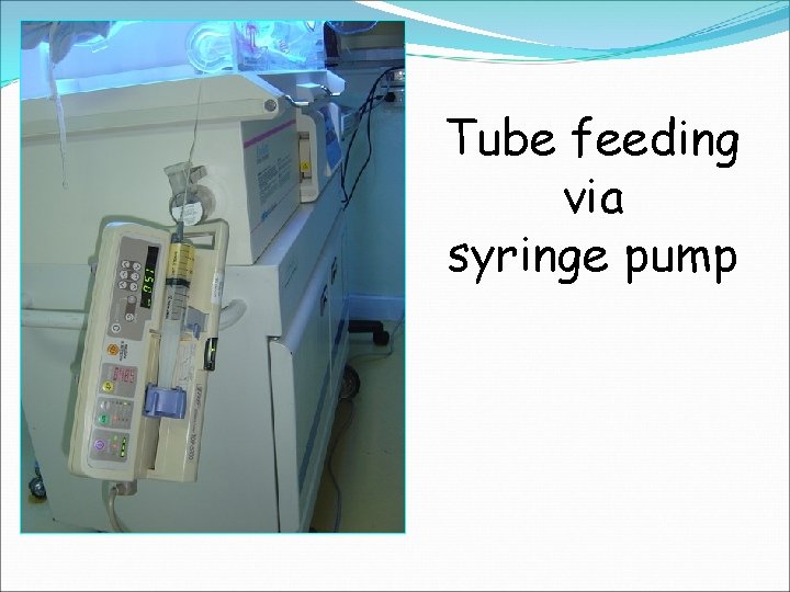 Tube feeding via syringe pump 