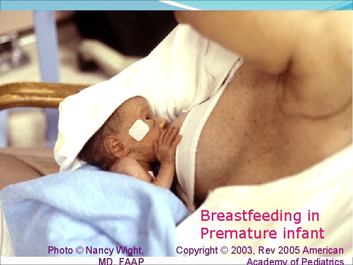 Breastfeeding in Premature infant Photo © Nancy Wight, Copyright © 2003, Rev 2005 American