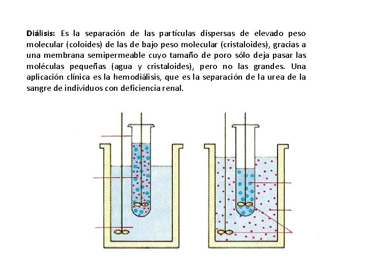 Diálisis: Es la separación de las partículas dispersas de elevado peso molecular (coloides) de Diálisis: Es la separación de las partículas dispersas de elevado peso molecular (coloides) de
