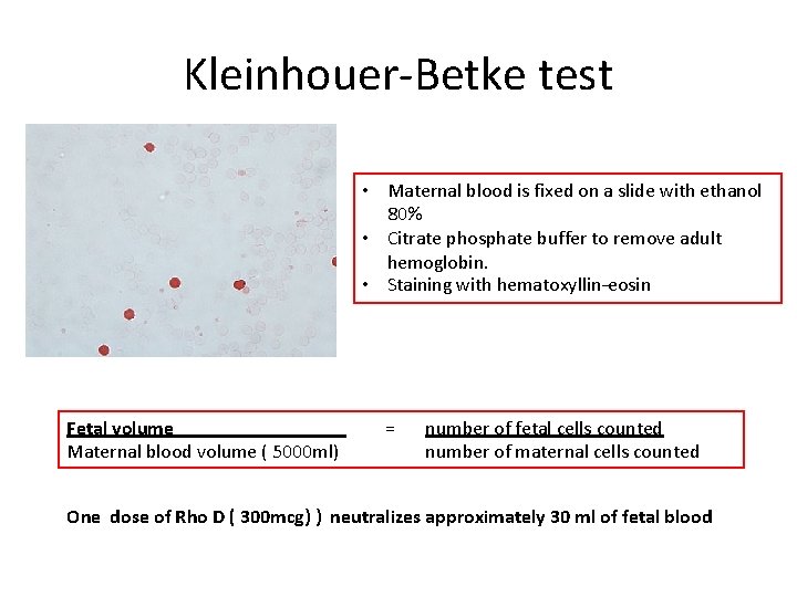 Kleinhouer-Betke test • Maternal blood is fixed on a slide with ethanol 80% •